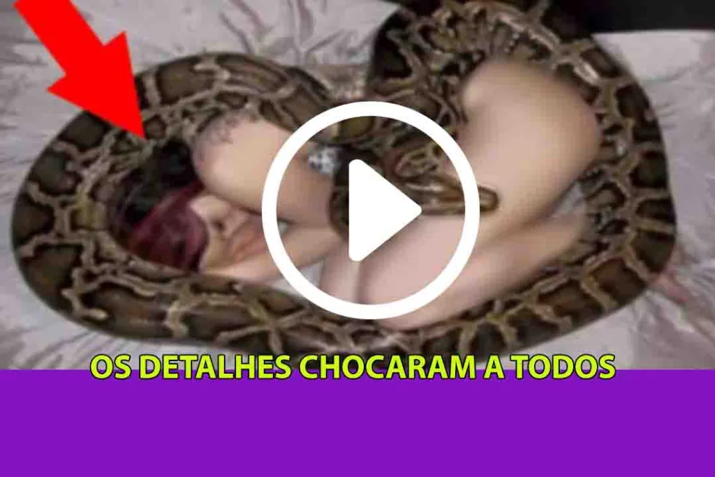 Após dormir com cobra de estimação, mulher sente algo estranho no corpo e ao ir ao médico descobre qu… Ver mais