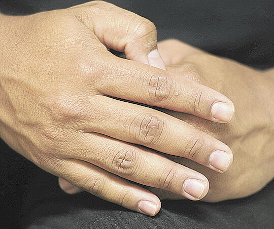 Homem Percebe Alterações Nas Unhas, Vai Ao Médico e Descobre Câncer No Pul…Ver mais