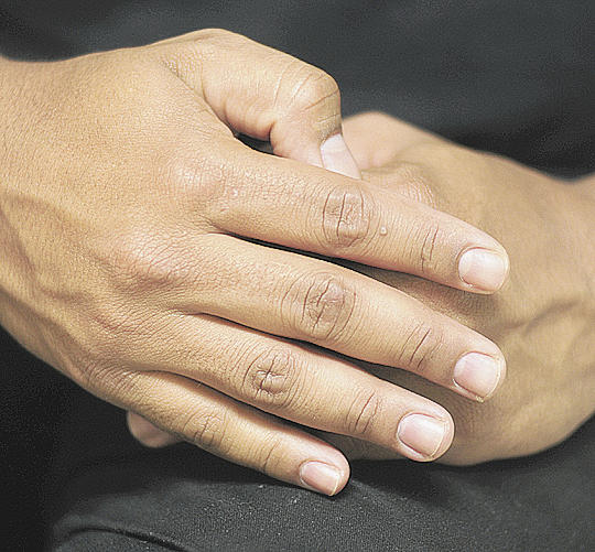 Homem Percebe Alterações Nas Unhas, Vai Ao Médico e Descobre Câncer No Pul…Ver mais