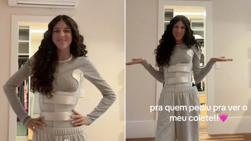 Estes São Os 05 Sintomas da Escoliose Que Rodrigo Farou Ignorou Em Sua Filha: “Est…Ver mais