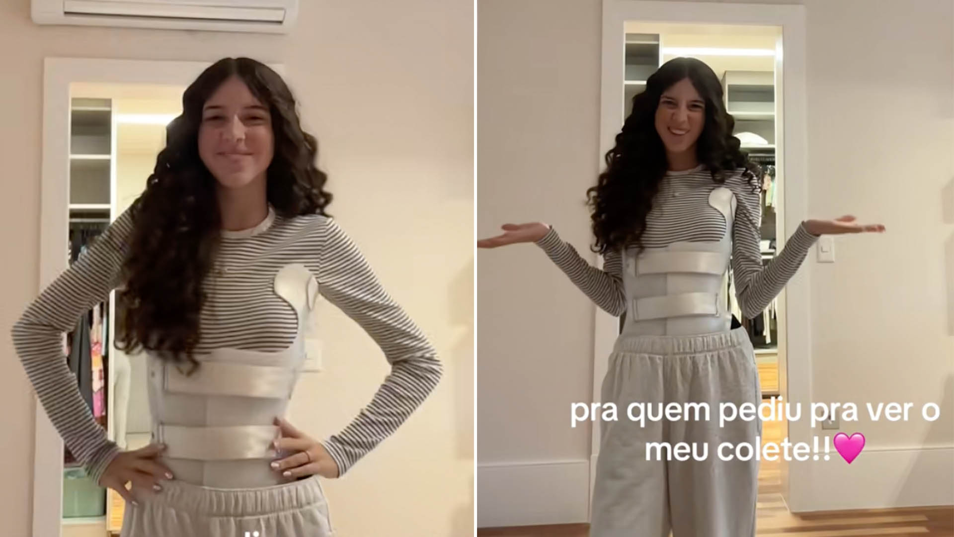 Estes São Os 05 Sintomas da Escoliose Que Rodrigo Farou Ignorou Em Sua Filha: “Est…Ver mais