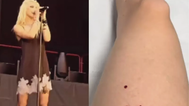 Cantora é Mordida Por Morcego Enquanto Fazia Suas…Ver mais