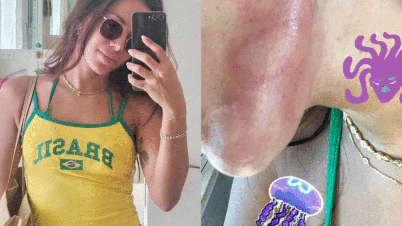 Nossa Querida Anitta Acaba de Sofrer Queimadura Dentro Da Sua…Ver mais