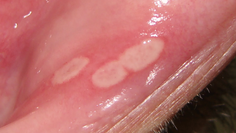 Feridas Labial Podem Surgir Na Vida das Mulheres Que Praticam Se…Ver mais