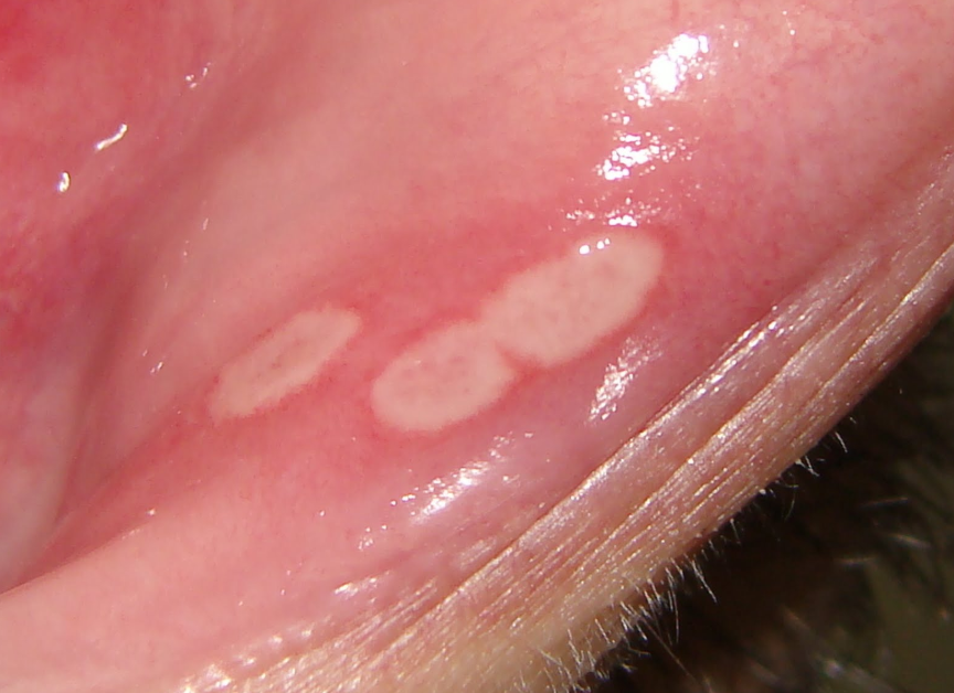 Feridas Labial Podem Surgir Na Vida das Mulheres Que Praticam Se…Ver mais